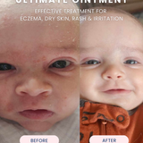 Ultimate Ointment, 3.4 oz